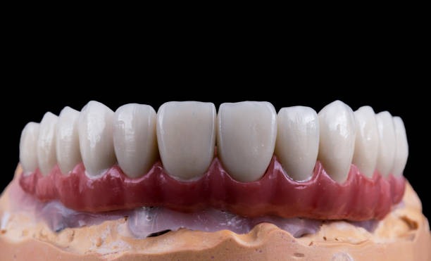 Fixed Dental Restorations