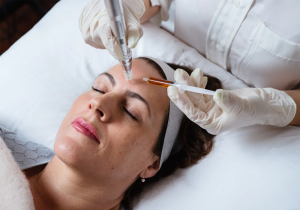 Treated with Mesotherapy