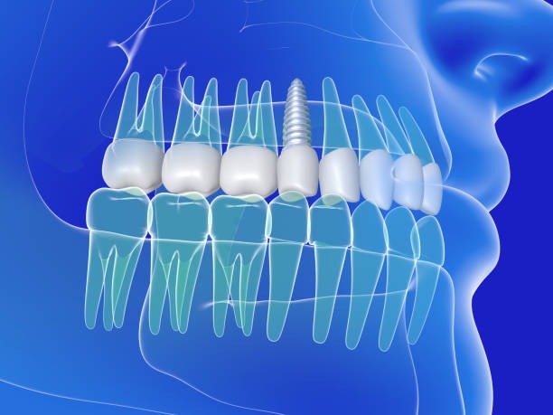 6 Cosmetic Dentistry Services That Work For Parents And Teens Alike