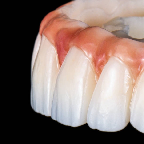 The Role Of Bioceramics In Durable Restorative Dentistry