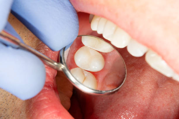 Preventive Dentistry Matters
