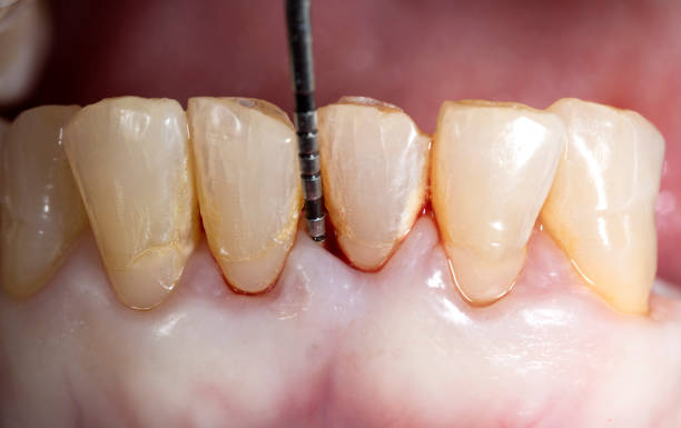The Connection Between Periodontal Disease And Overall Health