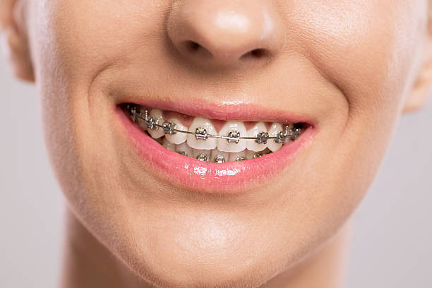 4 Orthodontic Services Families Commonly Choose