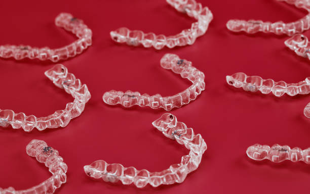 Clear Aligners