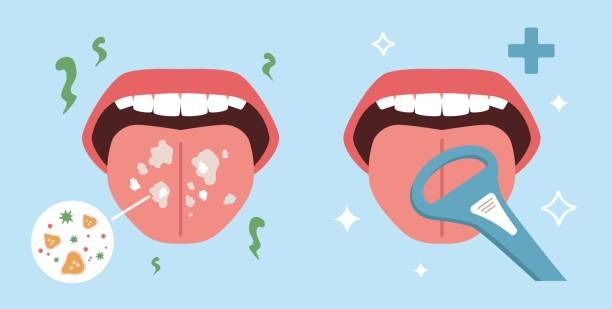 Why Saliva Plays An Important Role In Oral Health