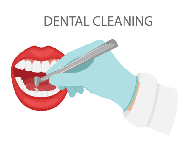 6 Benefits Of Professional Dental Cleanings In General Practice